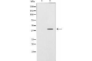 Western blot analysis on SK-OV3 cell lysate using NRG1 isoform-10 Antibody,The lane on the left is treated with the antigen-specific peptide. (Neuregulin 1 抗体  (N-Term))