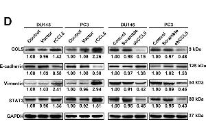Western Blotting (WB) image for anti-Signal Transducer and Activator of Transcription 3 (Acute-Phase Response Factor) (STAT3) (AA 40-240) antibody (ABIN6148567)