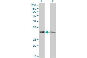 Western Blot analysis of CRSP8 expression in transfected 293T cell line by CRSP8 monoclonal antibody (M01), clone 8B8. (MED27 抗体  (AA 1-70))