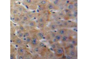 Used in DAB staining on fromalin fixed paraffin-embedded Liver tissue (IGFBP4 抗体  (AA 22-258))