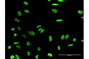 Immunofluorescence of purified MaxPab antibody to HN1L on HeLa cell. (HN1L 抗体  (AA 1-190))