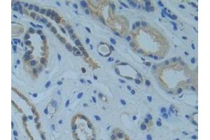 Immunohistochemistry (IHC) image for anti-SMAD Family Member 9 (SMAD9) (AA 226-459) antibody (ABIN7442282)