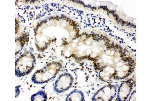 Anti-Lamin A+C antibody, IHC(P) IHC(P): Rat Intestine Tissue (Lamin A/C 抗体  (C-Term))