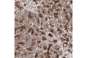Immunohistochemical staining of human pancreas with PVRL1 polyclonal antibody  shows strong cytoplasmic and membranous positivity in intercalated ducts at 1:50-1:200 dilution.