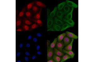 ABIN6265320 and ABIN6269360 staining Hela cells by IF/ICC.
