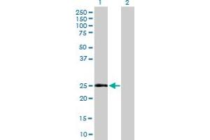 Western Blot analysis of CD69 expression in transfected 293T cell line by CD69 MaxPab polyclonal antibody.