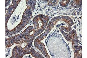 Image no. 2 for anti-Dynamin 1-Like (DNM1L) antibody (ABIN1497872) (Dynamin 1-Like 抗体)