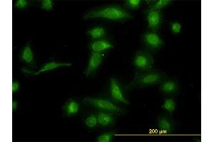 Immunofluorescence of monoclonal antibody to AKR1B10 on HeLa cell.
