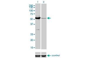 Western blot analysis of MUTYH over-expressed 293 cell line, cotransfected with MUTYH Validated Chimera RNAi (Lane 2) or non-transfected control (Lane 1). (MUTYH 抗体  (AA 436-535))