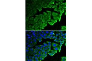 Immunofluorescence analysis of HeLa cells using RPLP0 antibody (ABIN6128686, ABIN6147163, ABIN6147165 and ABIN6221205). (RPLP0 抗体  (AA 1-317))
