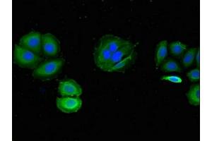 Immunofluorescent analysis of A549 cells using ABIN7175730 at dilution of 1:100 and Alexa Fluor 488-congugated AffiniPure Goat Anti-Rabbit IgG(H+L) (WDR19 抗体  (AA 45-226))