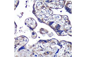 Immunohistochemistry of paraffin-embedded Human placenta using PASK Rabbit pAb (ABIN6128413, ABIN6145248, ABIN6145249 and ABIN6224850) at dilution of 1:100 (40x lens). (PASK 抗体  (AA 1194-1323))