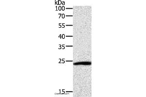 Western blot analysis of Hela cell, using SNAP25 Polyclonal Antibody at dilution of 1:400 (SNAP25 抗体)
