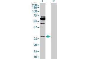 Western Blot analysis of HOXA5 expression in transfected 293T cell line by HOXA5 MaxPab polyclonal antibody. (HOXA5 抗体  (AA 1-270))
