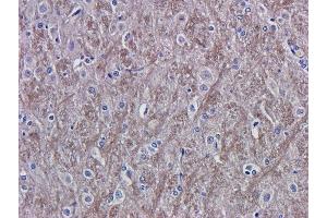 Immunohistochemical staining of rat brain tissue using anti-VEGF antibody  A. (Recombinant VEGF 抗体)