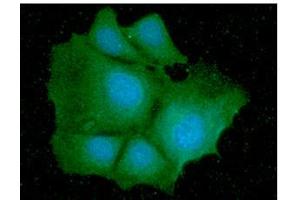 ICC/IF analysis of IDH1 in Hep3B cells line, stained with DAPI (Blue) for nucleus staining and monoclonal anti-human IDH1 antibody (1:100) with goat anti-mouse IgG-Alexa fluor 488 conjugate (Green).