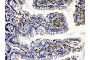 Immunohistochemistry (IHC) image for anti-Calpain 2 (CAPN2) (AA 500-700) antibody (ABIN5518897)