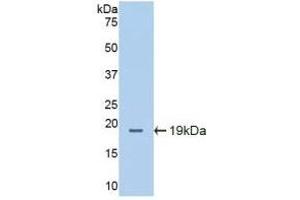 Detection of Recombinant ICAM1, Mouse using Polyclonal Antibody to Intercellular Adhesion Molecule 1 (ICAM1) (ICAM1 抗体  (AA 328-465))