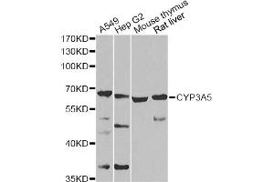 Western blot analysis of extracts of various cell lines, using CYP3A5 Antibody (ABIN2736613) at 1:1000 dilution. (CYP3A5 抗体)