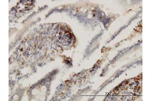 Immunoperoxidase of monoclonal antibody to ENTPD6 on formalin-fixed paraffin-embedded human small Intestine. (ENTPD6 抗体  (AA 386-484))