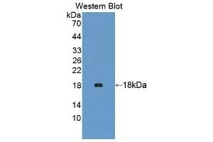Detection of Recombinant TRAPPC2, Human using Polyclonal Antibody to Trafficking Protein Particle Complex 2 (TRAPPC2) (TRAPPC2 抗体  (AA 1-140))