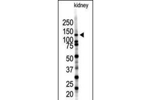 Western blot analysis of SENP7 polyclonal antibody in mouse kidney tissue lysate (35ug/lane). (SENP7 抗体  (C-Term))