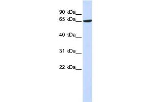 WB Suggested Anti-ADAM9 Antibody Titration:  0. (ADAM9 抗体  (Middle Region))