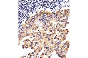 Immunohistochemical analysis of paraffin-embedded H. (PSMD10 抗体  (AA 43-76))