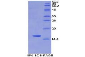 SDS-PAGE analysis of Rat Matrix Gla Protein. (MGP 蛋白)