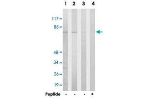 Western blot analysis of extracts from HeLa cells (Lane 1), Jurkat cells (Lane 2) and COLO 205 cells (Lane 3 and lane 4), using HKR1 polyclonal antibody . (HKR1 抗体)