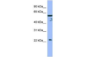 WB Suggested Anti-FAIM  Antibody Titration: 0. (FAIM 抗体  (Middle Region))