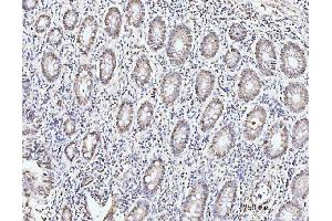 IHC analysis of KIFC1 using anti-KIFC1 antibody (ABIN7599523).