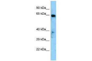 Western Blotting (WB) image for anti-Eyes Absent Homolog 1 (EYA1) (Middle Region) antibody (ABIN2779641) (EYA1 抗体  (Middle Region))