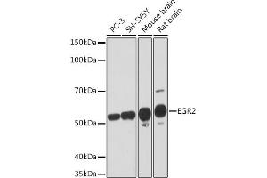 Western blot analysis of extracts of various cell lines, using EGR2 Rabbit mAb (ABIN1682321, ABIN7101509, ABIN7101510 and ABIN7101511) at 1:1000 dilution. (EGR2 抗体)