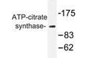 Western blot analysis of ATP-citrate synthase antibody in extracts from COS7 cells. (ACLY 抗体)