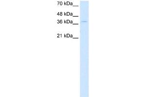 WB Suggested Anti-CTDSPL Antibody Titration:  0. (CTDSPL 抗体  (N-Term))