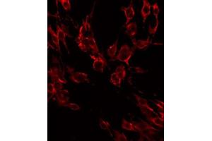 ABIN6268687 staining HeLa by IF/ICC. (IL2 Receptor beta 抗体  (N-Term))