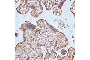 Immunohistochemistry (IHC) image for anti-Nuclear Factor (erythroid-Derived 2)-Like 1 (NFE2L1) (AA 515-772) antibody (ABIN7268969)