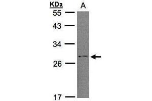 WB Image Sample (30μg whole cell lysate) A:H1299 12% SDS PAGE antibody diluted at 1:1000 (RGS2 抗体)