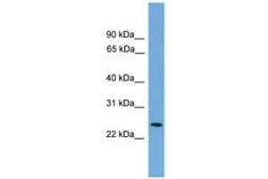 Image no. 1 for anti-Proteasome (Prosome, Macropain) Activator Subunit 2 (PA28 Beta) (PSME2) (AA 143-192) antibody (ABIN6746452) (PSME2 抗体  (AA 143-192))