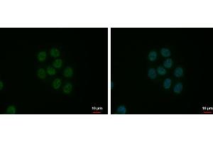 ICC/IF Image SFRS9 antibody detects SFRS9 protein at nucleus by immunofluorescent analysis. (SFRS9 抗体  (Center))