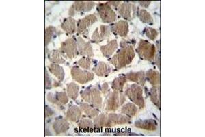 COCH Antibody (Center) (ABIN656833 and ABIN2846042) immunohistochemistry analysis in formalin fixed and paraffin embedded human skeletal muscle followed by peroxidase conjugation of the secondary antibody and DAB staining. (COCH 抗体  (AA 399-428))