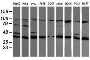 Image no. 5 for anti-Mitogen-Activated Protein Kinase Kinase 1 (MAP2K1) antibody (ABIN1499375) (MEK1 抗体)