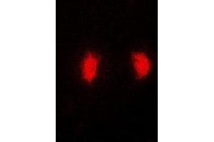 Immunofluorescent analysis of MRNP41 staining in MCF7 cells. (RAE1 抗体)