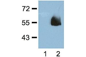 1:1000 (1 ug/ml) antibody dilution probed against HEK 293 cells transfected with HA-tagged protein vector; unstransfected (1) and transfected (2). (Hemagglutinin 抗体)