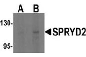 Western blot analysis of SPRYD2 in rat brain tissue lysate with SPRYD2 antibody at (A) 1 and (B) 2 μg/ml (CMYA5 抗体  (C-Term))