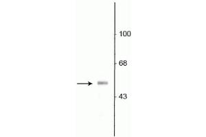 Western Blotting (WB) image for anti-Solute Carrier Family 32 (GABA Vesicular Transporter), Member 1 (SLC32A1) (N-Term) antibody (ABIN361418)