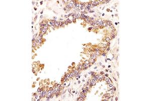 Immunohistochemistry (Paraffin-embedded Sections) (IHC (p)) image for anti-Zinc Finger (CCCH Type), RNA-Binding Motif and serine/arginine Rich 2 (ZRSR2) (AA 453-482), (C-Term) antibody (ABIN1882041)