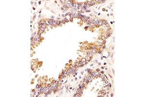 Immunohistochemical analysis of paraffin-embedded H. (ZRSR2 抗体  (C-Term))