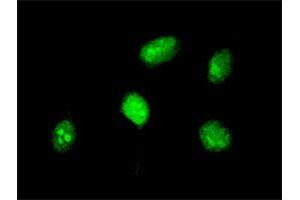 Immunofluorescence of monoclonal antibody to HOXA5 on HeLa cell. (HOXA5 抗体  (AA 171-270))